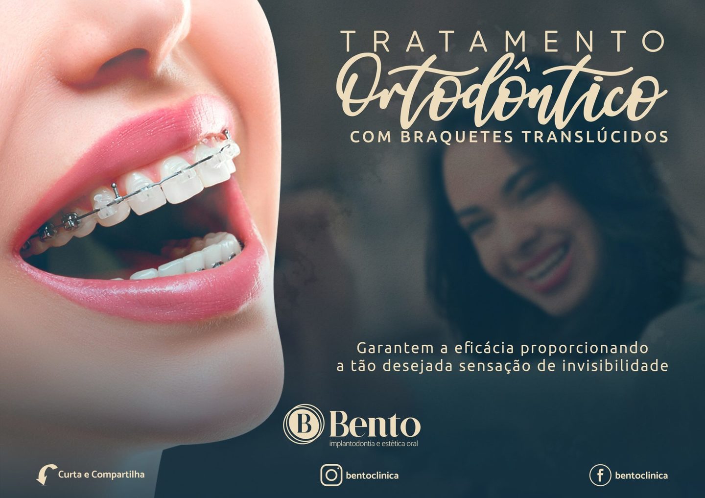 Bento Clínica- Implantodontia e estética oral. 