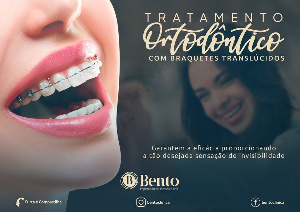 Bento Clínica- Implantodontia e estética oral. 